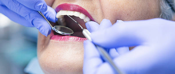 Best Emergency Wisdom Teeth Removal in Wills Point, TX